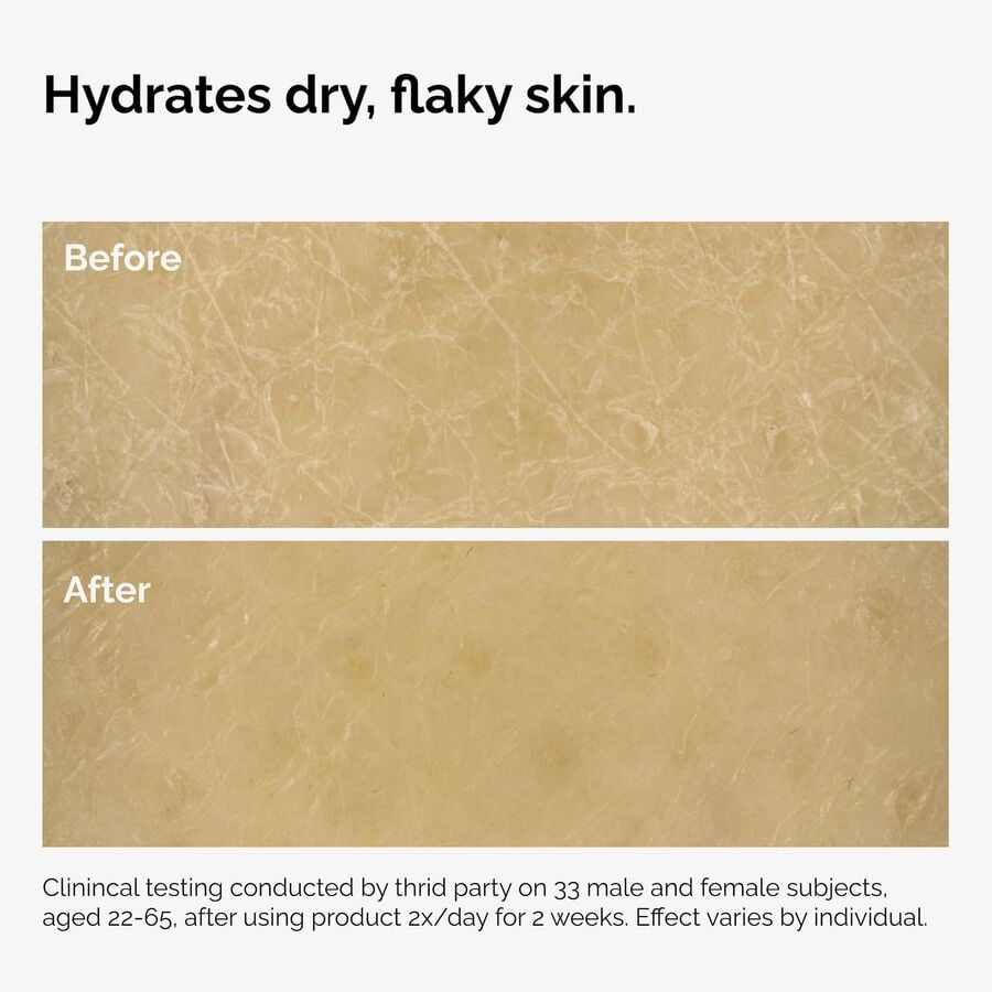 the-body-care-collection-r6 ord-natural-moisturizing-factors-inulin-body-before-after-graphic-02.jpg