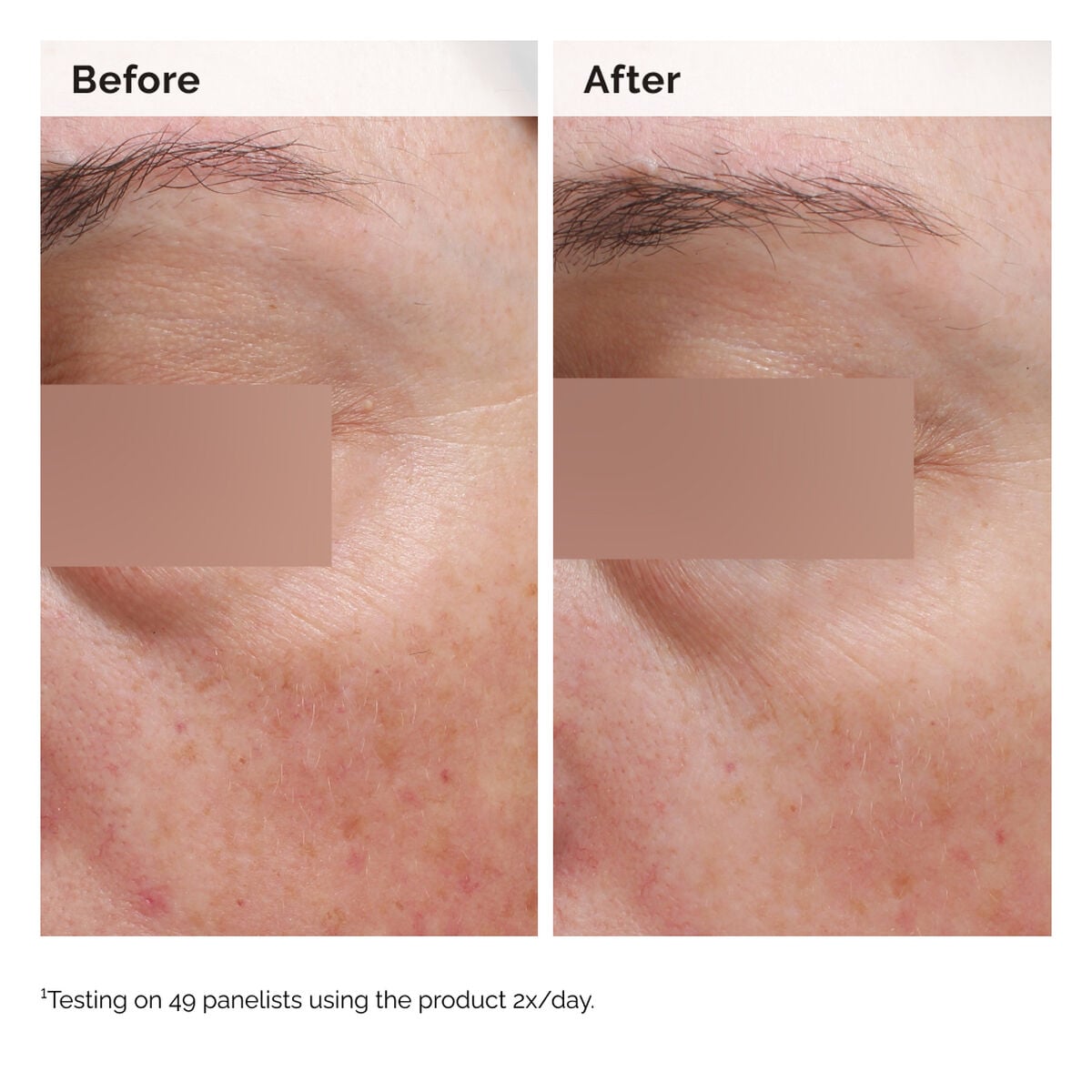 niacinamide-5-face-and-body-emulsion-u1 2024-08-23-ORD-Nia-5pct-Face-Body-B-A-Elasticity-Global-02-1x1.jpg