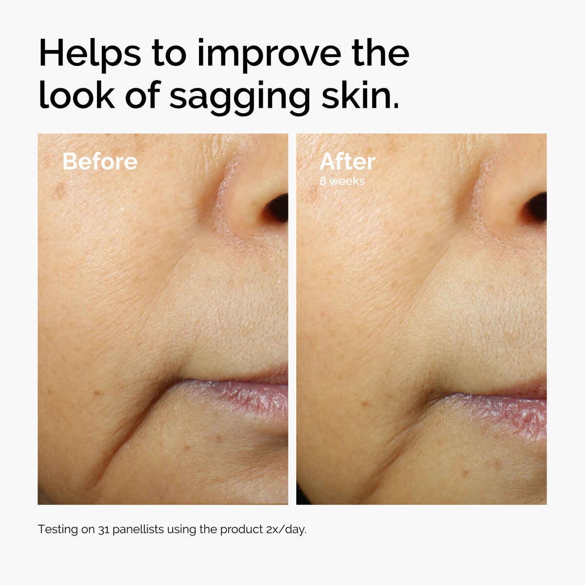 caffeine-3-escin-1-face-serum-z8 ord-caffeine-3pct-escin-1pct-face-serum-before-after-sagging.jpg