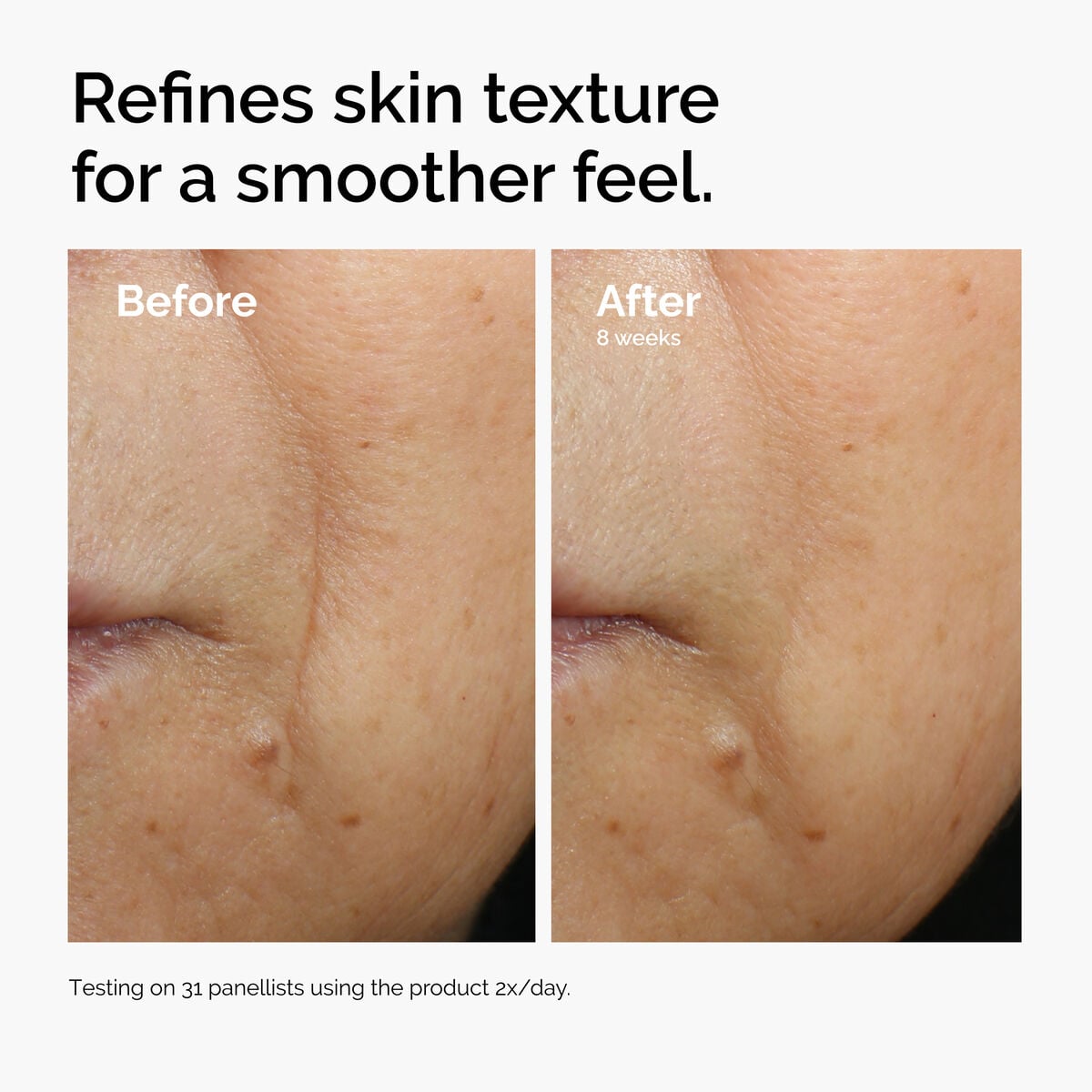caffeine-3-escin-1-face-serum-z8 ord-caffeine-3pct-escin-1pct-face-serum-before-after-texture.jpg