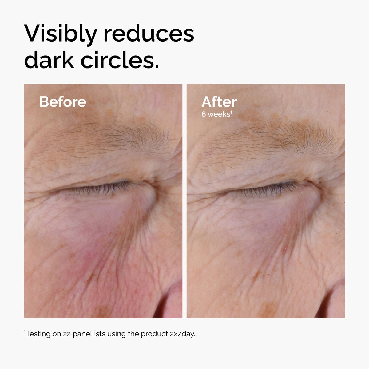 caffeine-solution-5-egcg-eye-serum-y6 ord-caffeine-solution-egcg-dark-circles-before-after.jpg