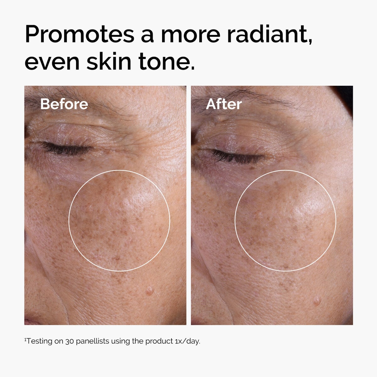 glycolic-acid-7-exfoliating-toner-h0 ord-glycolic-before-after-radiance.jpg