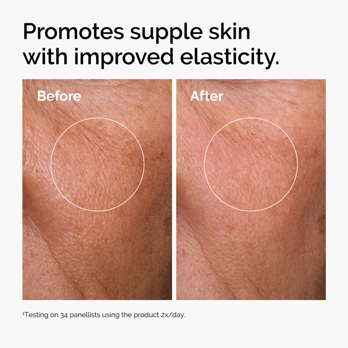 hyaluronic-acid-2-b5-with-ceramides-a7 ord-hyaluronic-acid-2pct-b5-hydrating-serum-before-after-elasticity.jpg