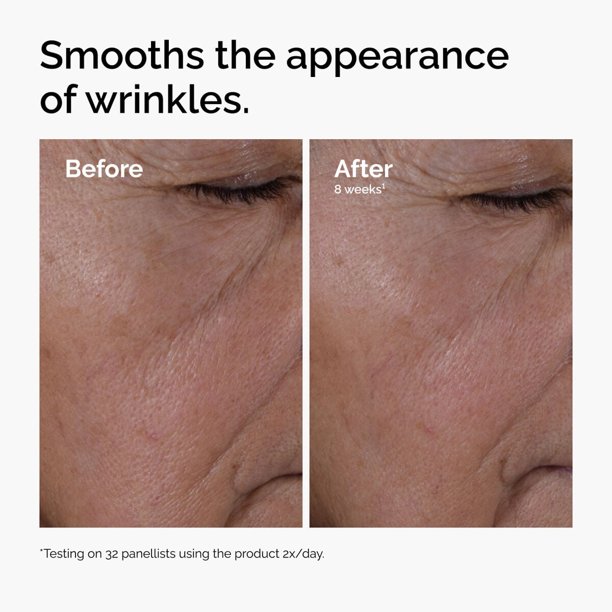 multi-peptide-ha-serum-x6 ord-multi-peptide-ha-serum-wrinkles-before-after.jpg