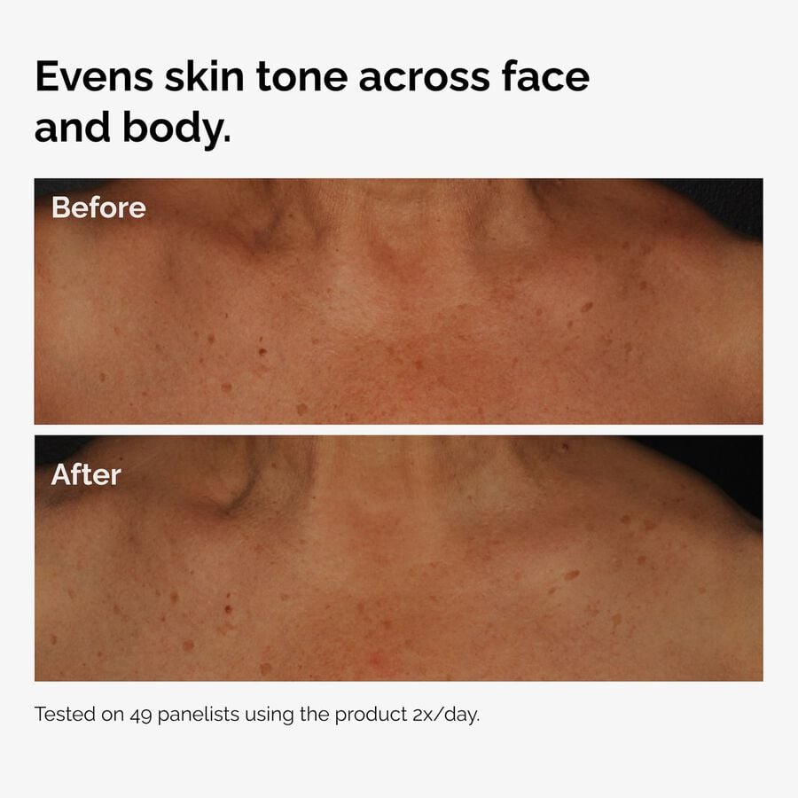 the-body-care-collection-r6 ord-niacinamide-face-body-serum-before-after-even-tone-graphic.jpg