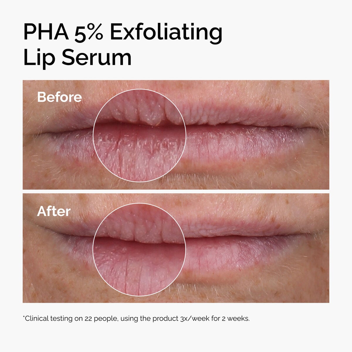 pha-5-exfoliating-lip-serum-x1 ord-pha-5pct-lip-exfoliating-serum-before-after.jpg